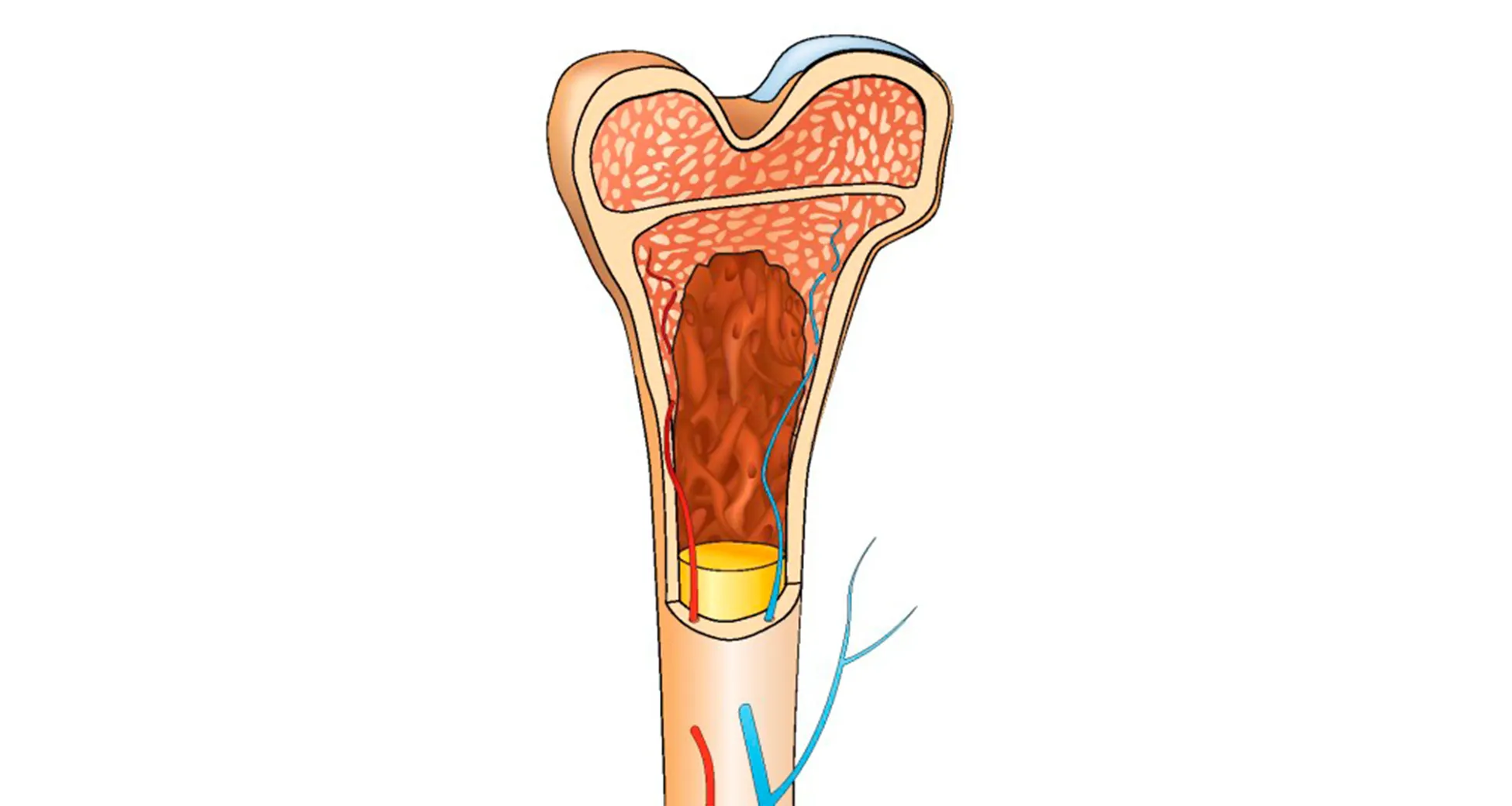 Fevereiro Laranja - Medula Óssea